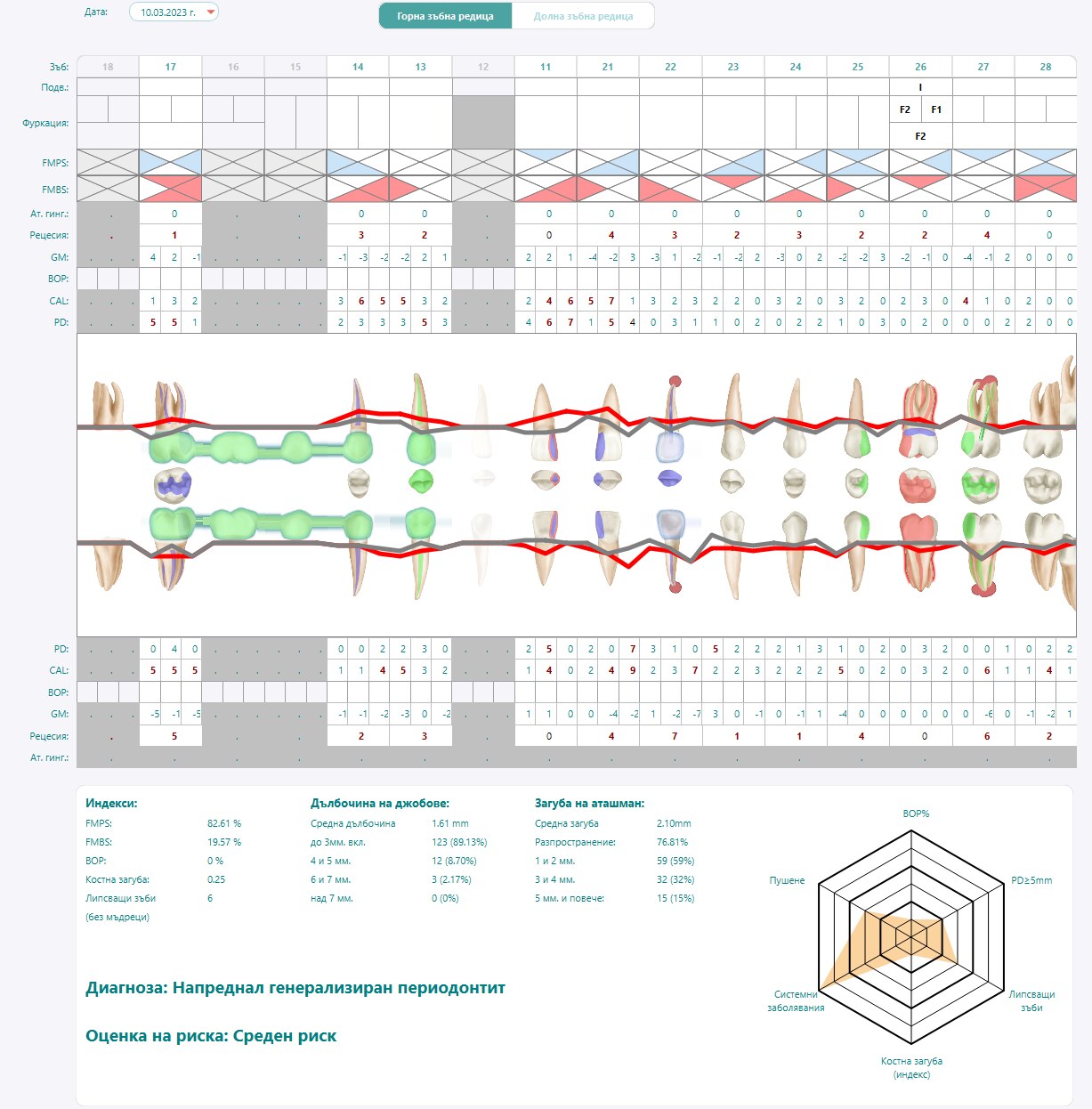 DinoDent treatment and charting view — authentic screenshot from the official repository DinoDent periodontal and treatment view